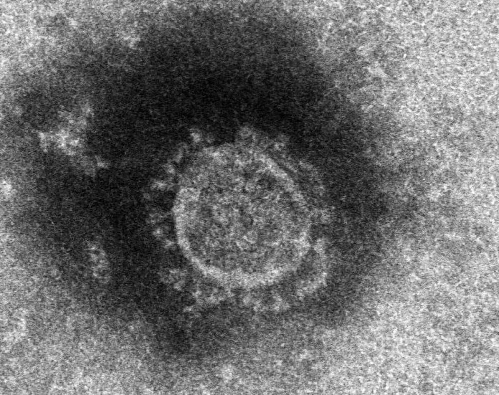 新型コロナウイルスの顕微鏡写真=国立感染症研究所撮影