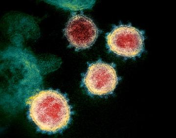 新型コロナウイルスの電子顕微鏡写真(米国立アレルギー感染症研究所提供)