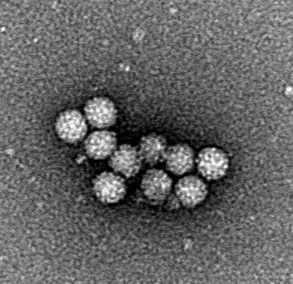 ノロウイルスの電子顕微鏡写真(国立感染症研究所提供)