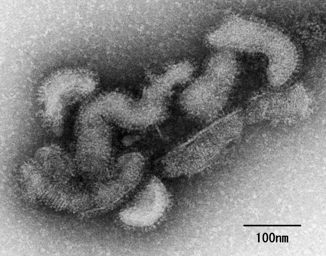 オズウイルス粒子の電子顕微鏡写真（国立感染症研究所提供）